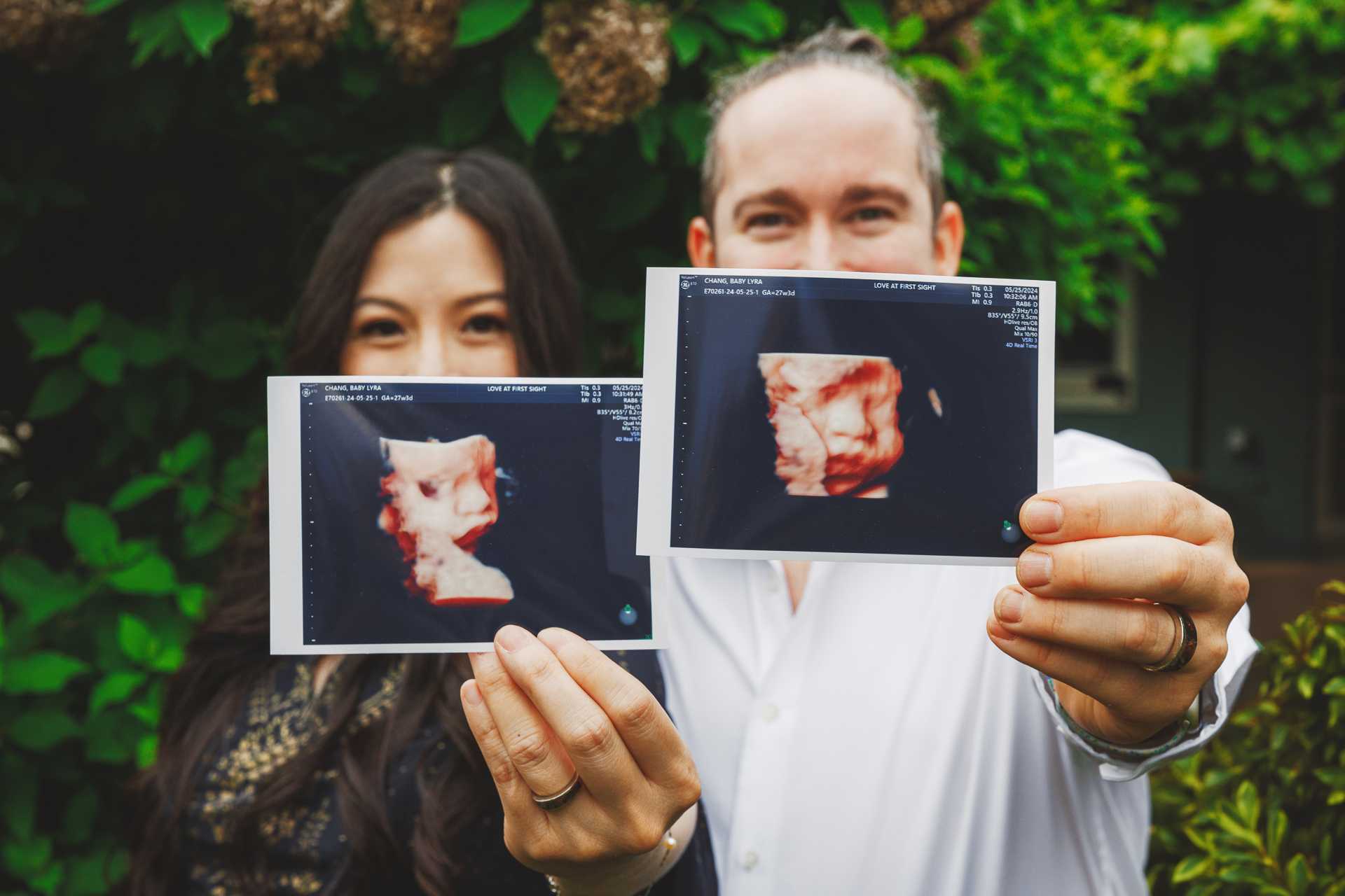 A couple standing outdoors holds up two grainy ultrasound images, both smiling at the camera with joy. The lush greenery in the background frames their moment perfectly, making it seem like an auto draft from a storybook.